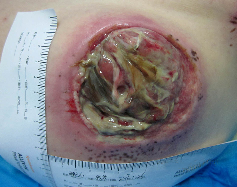 Wound Before Treatment